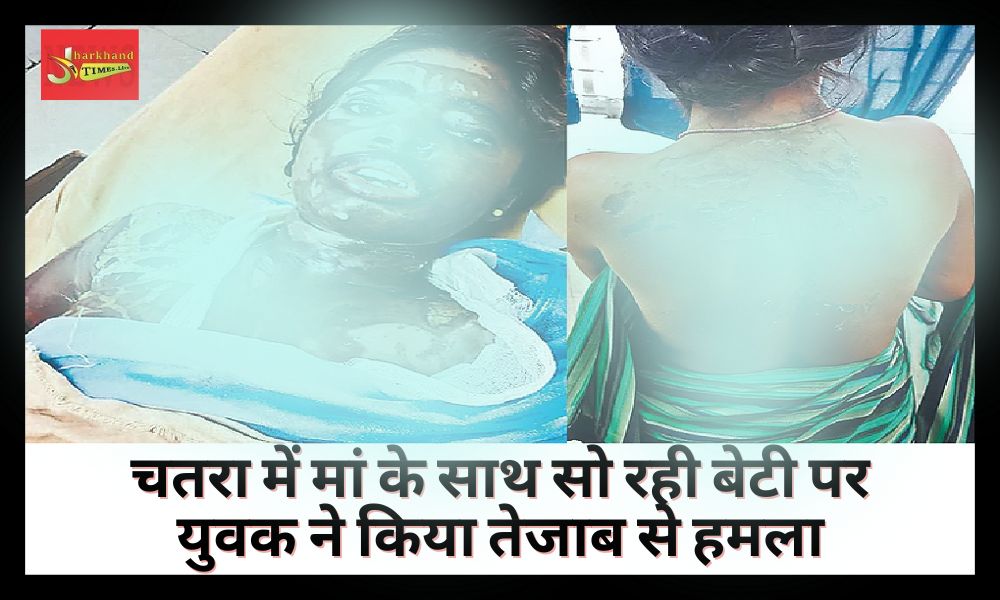 Young man attacked with acid on daughter sleeping with mother in Chatra